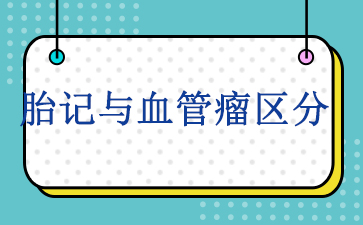 广州看血管瘤医院哪个好-胎记与血管瘤区分