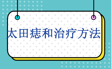 广州专门看胎记的医院-太田痣和治疗方法