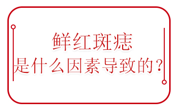 广州胎记医院前十名-鲜红斑痣的形成原因是什么？