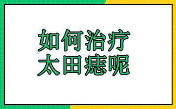 广州治胎记手术多少费用-如何治疗太田痣呢