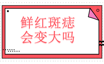 广州哪个医院能治鲜红斑痣-鲜红斑痣会变大吗