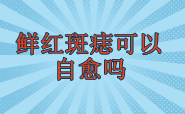 广州治疗鲜红斑痣的医院-鲜红斑痣可以自愈吗