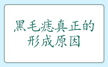 「患者信赖“广州治疗胎记排名”」实力品牌[傲人口碑]-黑毛痣真正的形成原因