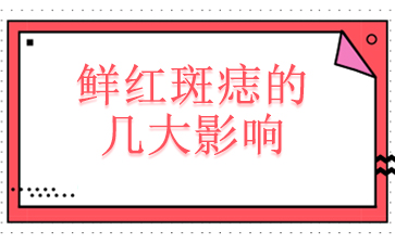 重点排名_广州去除鲜红斑痣医院排名-鲜红斑痣的几大影响