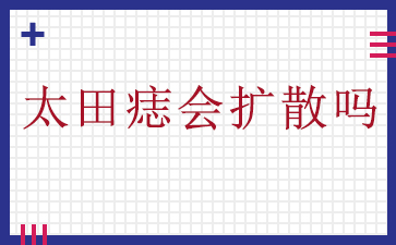 重点推荐：广州治疗胎记好的医院-太田痣会扩散吗