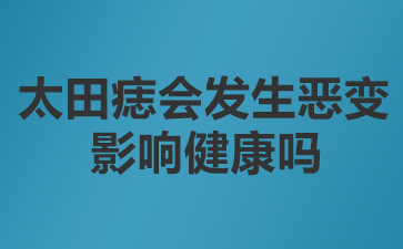 广州看太田痣哪家医院好-太田痣会发生恶变影响健康吗