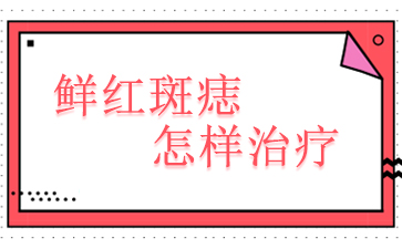 治疗鲜红斑痣广州哪家医院好-鲜红斑痣怎样治疗