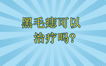 [排名靠前]广州哪里可以治黑毛痣-黑毛痣可以治疗吗?