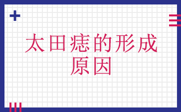 广州治太田痣哪家医院比较好-太田痣的形成原因