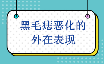 [排名靠前]广州哪里可以治黑毛痣_黑毛痣恶化的外在表现